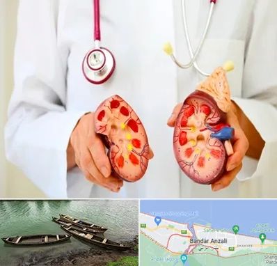 دکتر سنگ کلیه در بندر انزلی