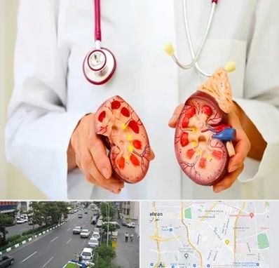 دکتر سنگ کلیه در ستارخان 