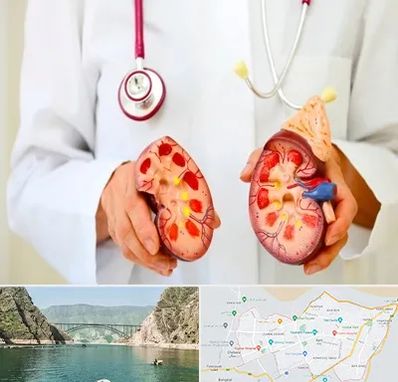 دکتر سنگ کلیه در ایلام