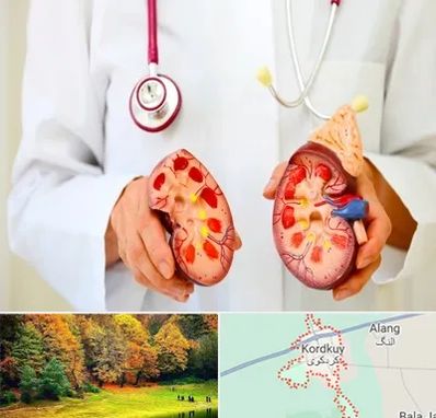 دکتر سنگ کلیه در کردکوی