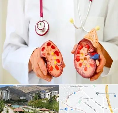 دکتر سنگ کلیه در شهر زیبا 