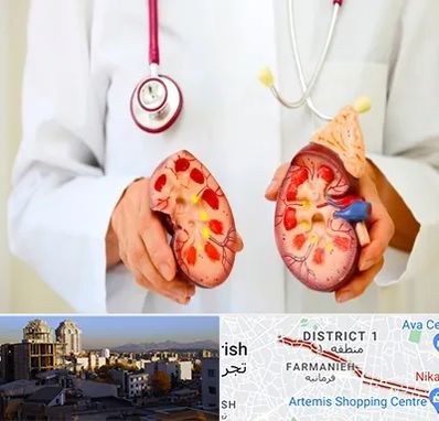 دکتر سنگ کلیه در فرمانیه 