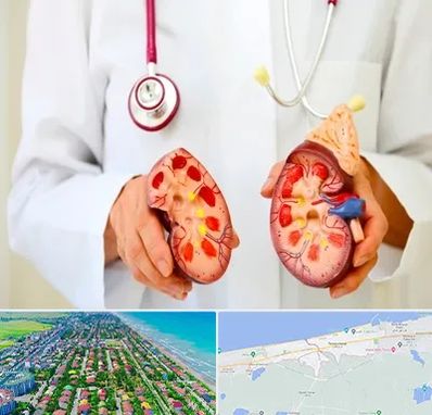 دکتر سنگ کلیه در فریدونکنار