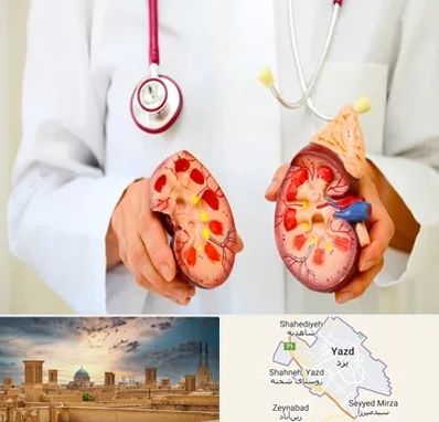 دکتر سنگ کلیه در یزد