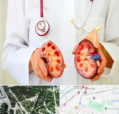 دکتر سنگ کلیه در سالاریه قم