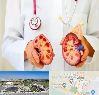دکتر سنگ کلیه در ملارد