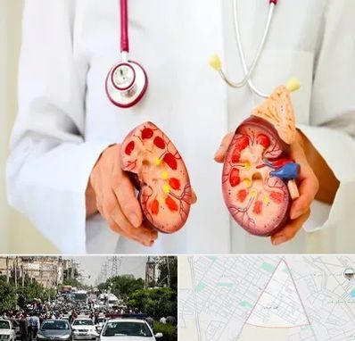 دکتر سنگ کلیه در سیدی مشهد