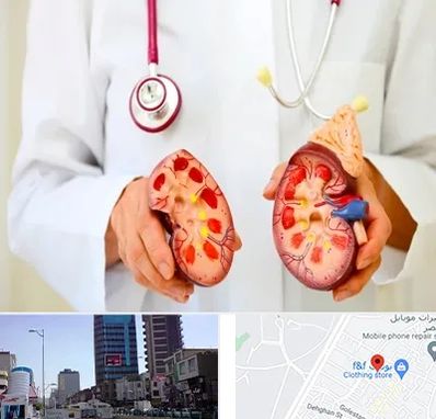 دکتر سنگ کلیه در چهارراه طالقانی کرج 