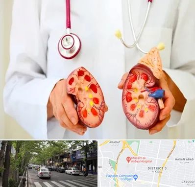 دکتر سنگ کلیه در ظفر 