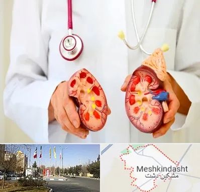 دکتر سنگ کلیه در مشکین دشت