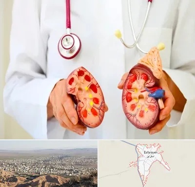 دکتر سنگ کلیه در اسفراین