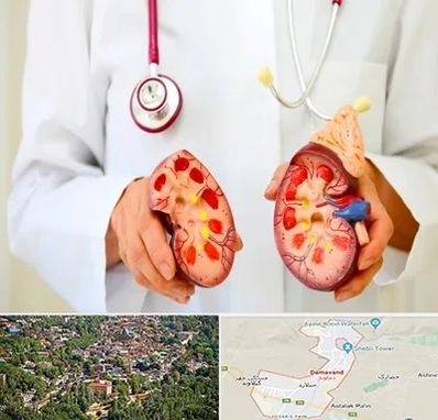 دکتر سنگ کلیه در دماوند