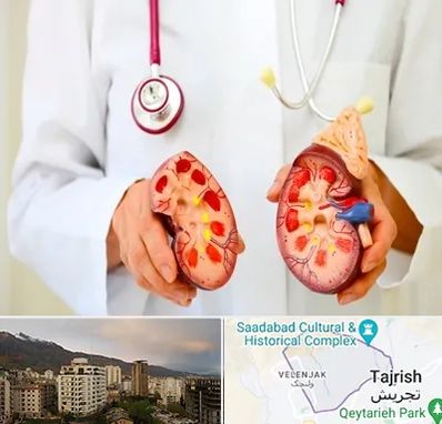 دکتر سنگ کلیه در زعفرانیه 