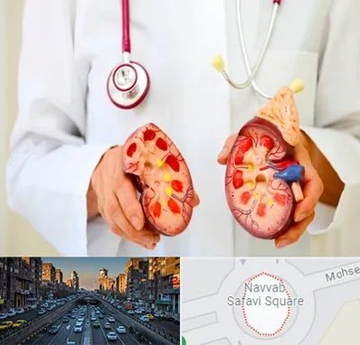 دکتر سنگ کلیه در نواب 