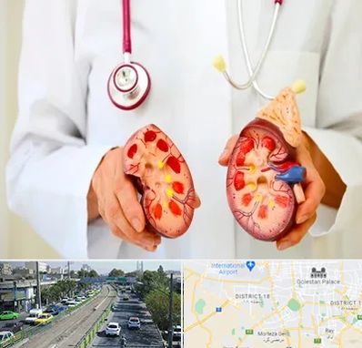 دکتر سنگ کلیه در جنوب تهران 