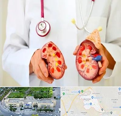 دکتر سنگ کلیه در نسیم شهر