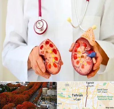 دکتر سنگ کلیه در ولیعصر 