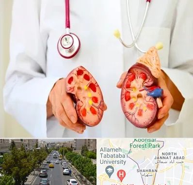 دکتر سنگ کلیه در شهران 