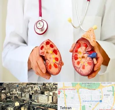 دکتر سنگ کلیه در مرزداران 