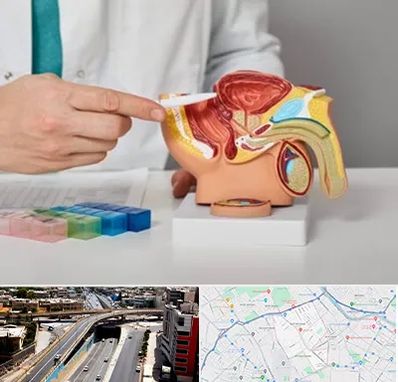 دکتر پروستات در ستارخان شیراز 