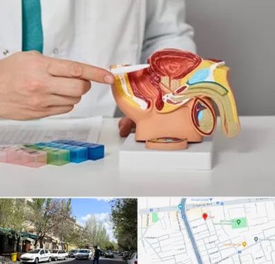 دکتر پروستات در کوی فیروز تبریز