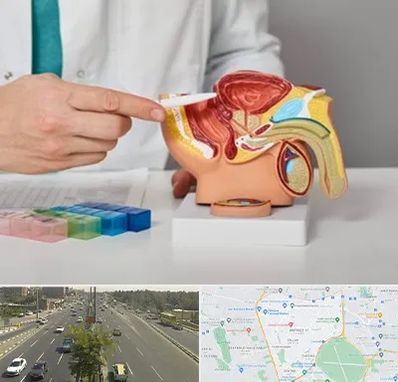 دکتر پروستات در منطقه 17 تهران 