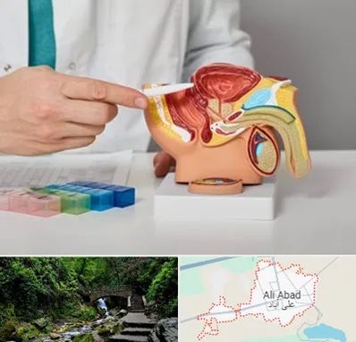 دکتر پروستات در علی‌ آباد کتول