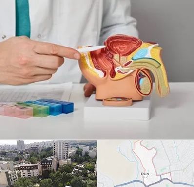 دکتر پروستات در اوین