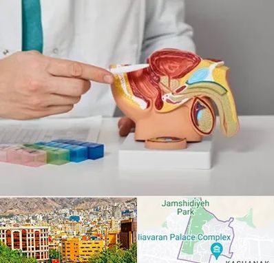 دکتر پروستات در نیاوران 