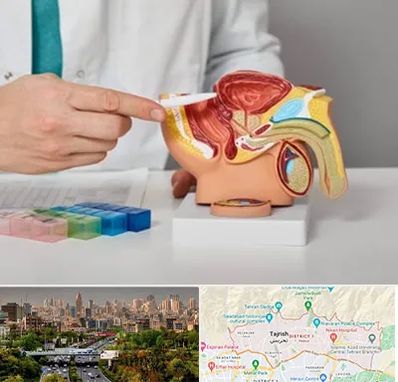 دکتر پروستات در منطقه 1 تهران 