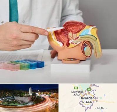 دکتر پروستات در همدان