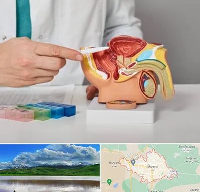 دکتر پروستات در مرند