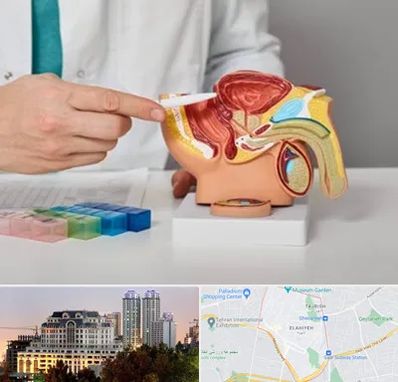 دکتر پروستات در فرشته 