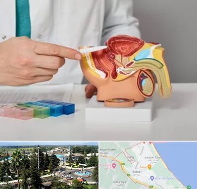 دکتر پروستات در رودسر