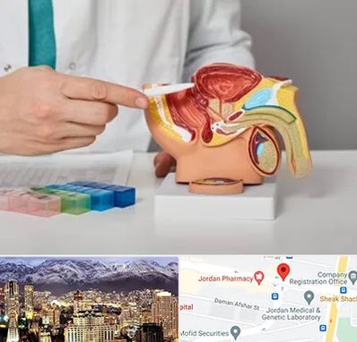 دکتر پروستات در جردن 