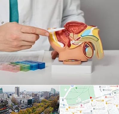 دکتر پروستات در بلوار کشاورز 