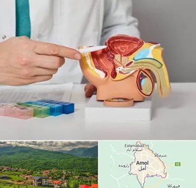 دکتر پروستات در آمل