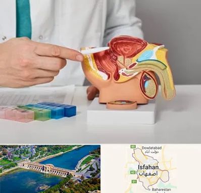 دکتر پروستات در اصفهان