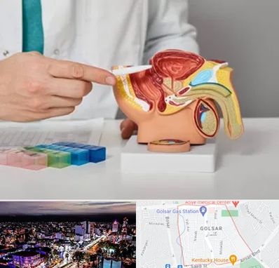 دکتر پروستات در گلسار رشت 