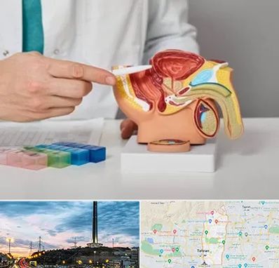 دکتر پروستات در منطقه 2 تهران 