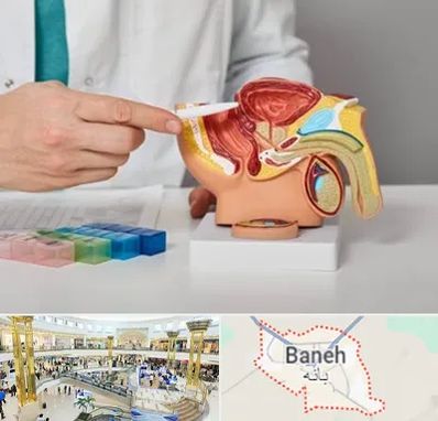 دکتر پروستات در بانه