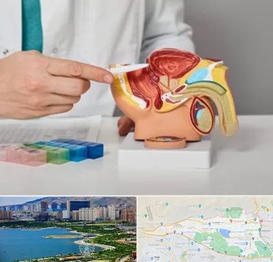 دکتر پروستات در منطقه 22 تهران 