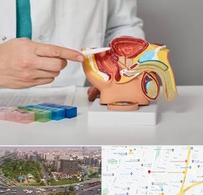 دکتر پروستات در آیت الله کاشانی