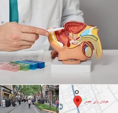 دکتر پروستات در ولیعصر شهریار