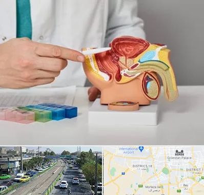 دکتر پروستات در جنوب تهران 