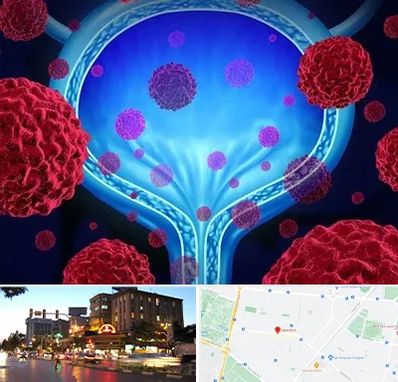 دکتر سرطان مثانه در بلوار سجاد مشهد 