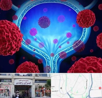 دکتر سرطان مثانه در ایران زمین