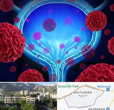 دکتر سرطان مثانه در اختیاریه 