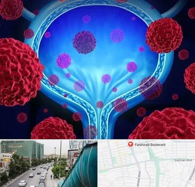 دکتر سرطان مثانه در بلوار فرحزادی