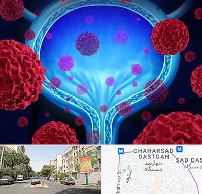 دکتر سرطان مثانه در چهارصد دستگاه 